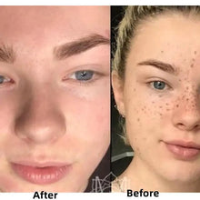 Load image into Gallery viewer, BrightGlow Turmeric Radiance Serum - Unleash Your Skin's Natural Glow