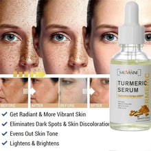 Load image into Gallery viewer, BrightGlow Turmeric Radiance Serum - Unleash Your Skin's Natural Glow