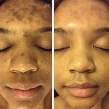Load image into Gallery viewer, BrightGlow Turmeric Radiance Serum - Unleash Your Skin's Natural Glow