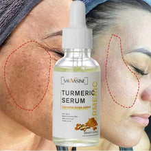 Load image into Gallery viewer, BrightGlow Turmeric Radiance Serum - Unleash Your Skin's Natural Glow
